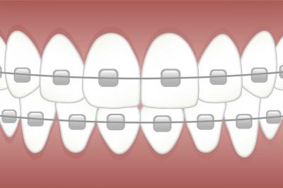 orthodontiste sarcelles