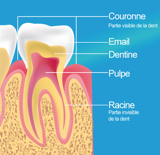 Le Centre dentaire Sarcelles-Garges les Gonesse à Sarcelles (95), vous présente le principe de l'endodontie, ou dévitalisation.