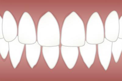 implant dentaire sarcelles